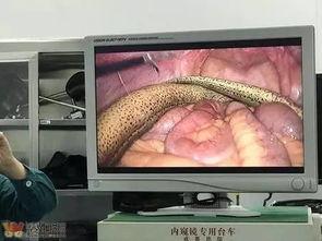 鳝鱼门视频完整版,揭秘神秘鳝鱼世界的传奇故事